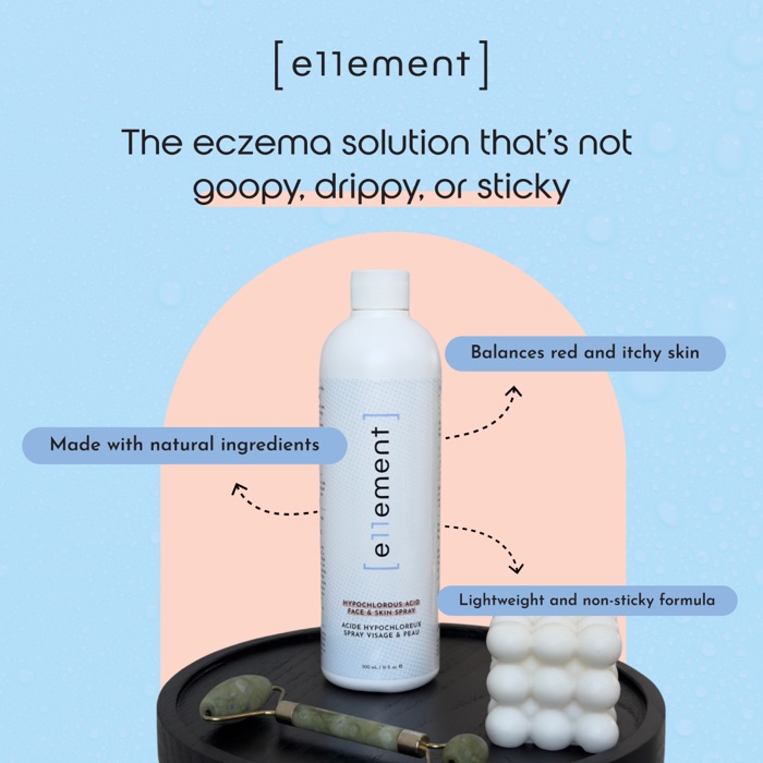 Static · Eczema